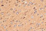 GLS Antibody in Immunohistochemistry (Paraffin) (IHC (P))