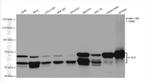 GLS Antibody in Western Blot (WB)