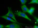 DRP1 Antibody in Immunocytochemistry (ICC/IF)