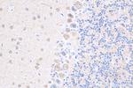 DRP1 Antibody in Immunohistochemistry (Paraffin) (IHC (P))