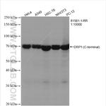 DRP1 Antibody in Western Blot (WB)