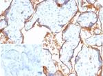 Nectin 4/Nectin Cell Adhesion Molecule 4/PVRL4 Antibody in Immunohistochemistry (Paraffin) (IHC (P))