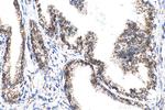 ECHS1 Antibody in Immunohistochemistry (Paraffin) (IHC (P))