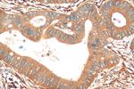 pan-RAS Antibody in Immunohistochemistry (Paraffin) (IHC (P))