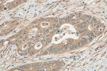 JNK Antibody in Immunohistochemistry (Paraffin) (IHC (P))