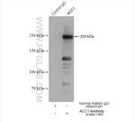 ACC1 Antibody in Immunoprecipitation (IP)