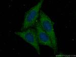 mTOR Antibody in Immunocytochemistry (ICC/IF)