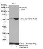 Phospho-CHEK2 (Thr68) Antibody in Western Blot (WB)