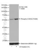 Phospho-CHEK2 (Thr68) Antibody in Western Blot (WB)