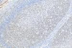 BCL6 Antibody in Immunohistochemistry (Paraffin) (IHC (P))