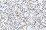 BCL6 Antibody in Immunohistochemistry (Paraffin) (IHC (P))