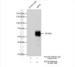 ATF4 Antibody in Immunoprecipitation (IP)