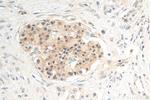 PIN1 Antibody in Immunohistochemistry (Paraffin) (IHC (P))