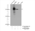 USP9X Antibody in Immunoprecipitation (IP)