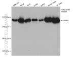 USP9X Antibody in Western Blot (WB)