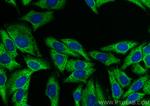 DDX3 Antibody in Immunocytochemistry (ICC/IF)