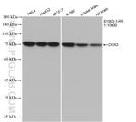 DDX3 Antibody in Western Blot (WB)