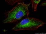 MAVS/VISA Antibody in Immunocytochemistry (ICC/IF)