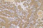 MAVS/VISA Antibody in Immunohistochemistry (Paraffin) (IHC (P))