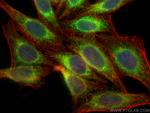 Calnexin Antibody in Immunocytochemistry (ICC/IF)