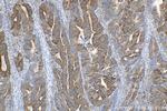 PHGDH Antibody in Immunohistochemistry (Paraffin) (IHC (P))