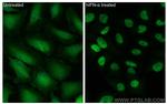 STAT1 Antibody in Immunocytochemistry (ICC/IF)