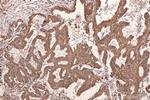 STAT1 Antibody in Immunohistochemistry (Paraffin) (IHC (P))