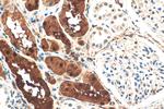 ZEB2 Antibody in Immunohistochemistry (Paraffin) (IHC (P))