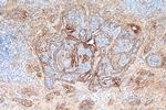 Galectin 3 Antibody in Immunohistochemistry (Paraffin) (IHC (P))