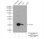 Galectin 3 Antibody in Immunoprecipitation (IP)