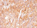 Calnexin Antibody in Immunohistochemistry (Paraffin) (IHC (P))