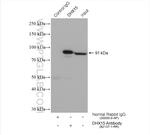 DHX15 Antibody in Immunoprecipitation (IP)