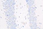 Caspase 3 Antibody in Immunohistochemistry (Paraffin) (IHC (P))