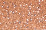 ATP5A1 Antibody in Immunohistochemistry (Paraffin) (IHC (P))