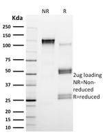Calpain 1 Antibody in SDS-PAGE (SDS-PAGE)