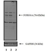 FOXO1 Antibody in Western Blot (WB)