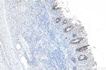 Cytokeratin 20 Antibody in Immunohistochemistry (Paraffin) (IHC (P))