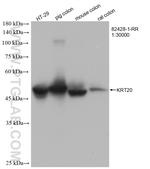 Cytokeratin 20 Antibody in Western Blot (WB)