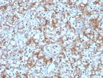 Calpastatin Antibody in Immunohistochemistry (Paraffin) (IHC (P))