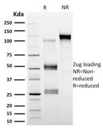 Calpastatin Antibody in SDS-PAGE (SDS-PAGE)