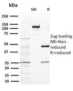 BAP1 (BRCA1 Associated Protein 1) Antibody in SDS-PAGE (SDS-PAGE)