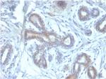 BAP1 (BRCA1 Associated Protein 1) Antibody in Immunohistochemistry (Paraffin) (IHC (P))