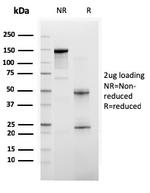 BAP1 (BRCA1 Associated Protein 1) Antibody in SDS-PAGE (SDS-PAGE)