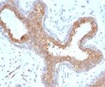 BAP1 (BRCA1 Associated Protein 1) Antibody in Immunohistochemistry (Paraffin) (IHC (P))