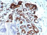 BAP1 (BRCA1 Associated Protein 1) Antibody in Immunohistochemistry (Paraffin) (IHC (P))