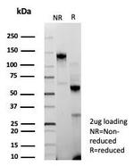 BAP1 (BRCA1 Associated Protein 1) Antibody in Immunohistochemistry (Paraffin) (IHC (P))