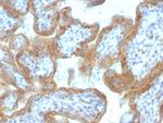 MAML2 (Mastermind Like Transcriptional Coactivator 2) Antibody in Immunohistochemistry (Paraffin) (IHC (P))