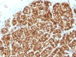 MAML2 (Mastermind Like Transcriptional Coactivator 2) Antibody in Immunohistochemistry (Paraffin) (IHC (P))