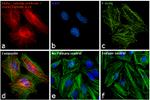 Mouse IgG (H+L) Secondary Antibody in Immunocytochemistry (ICC/IF)