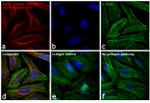 Mouse IgG (H+L) Secondary Antibody in Immunocytochemistry (ICC/IF)